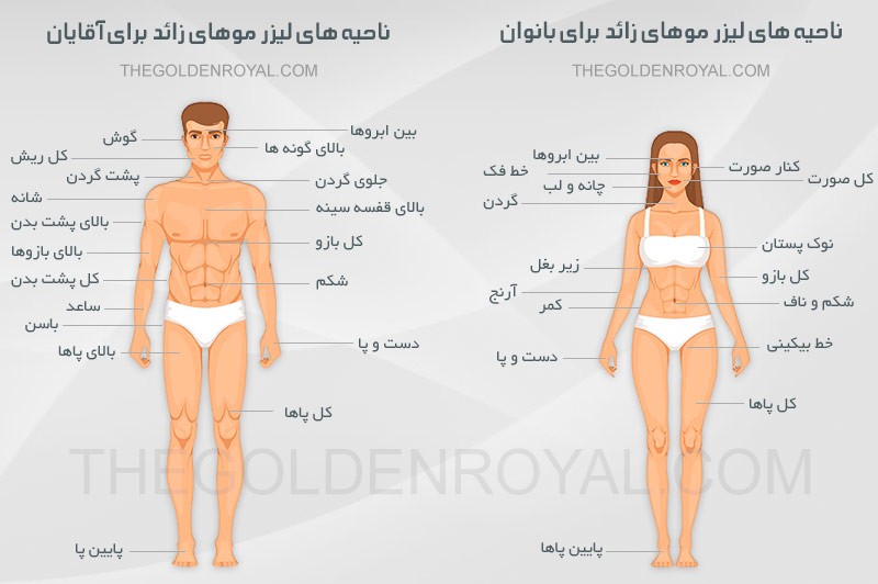 نواحی لیزر موهای زائد برای آقایان و خانم ها