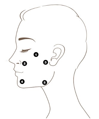تکنیک BAP (نقاط مرتبط با زیبایی) در تزریق ژل پروفایلو