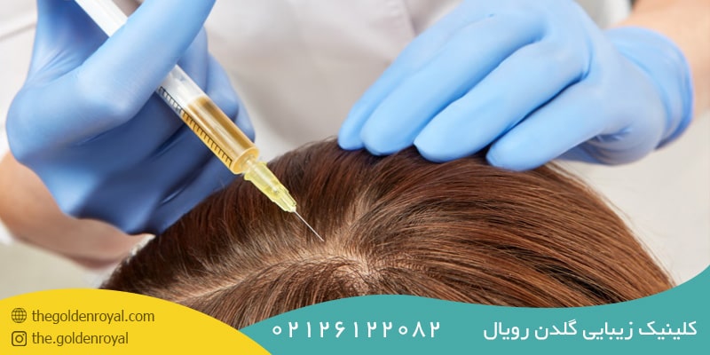 مزایا و عوارض مزوتراپی مو چیست