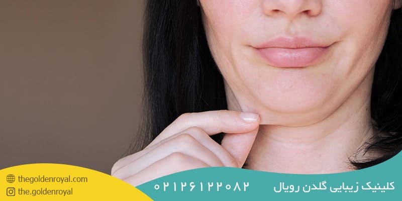افتادگی پوست زیر چانه