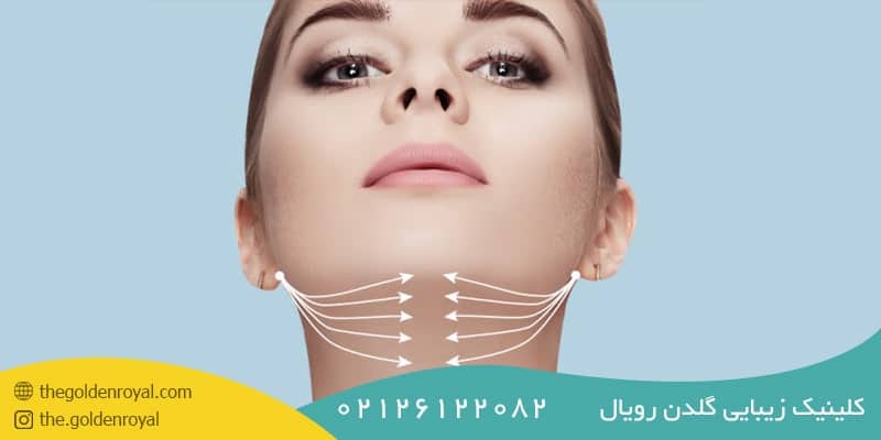 بهترین روش لیفت گردن