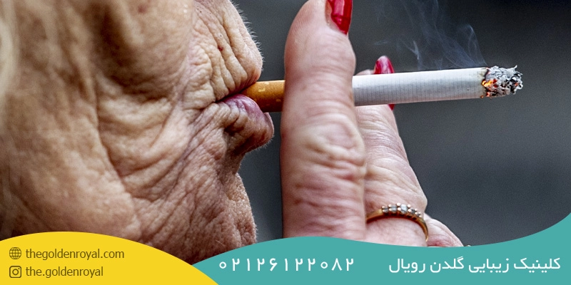 سیگار کشیدن یکی از مهمترین دلایل جوش صورت در سنین بالا